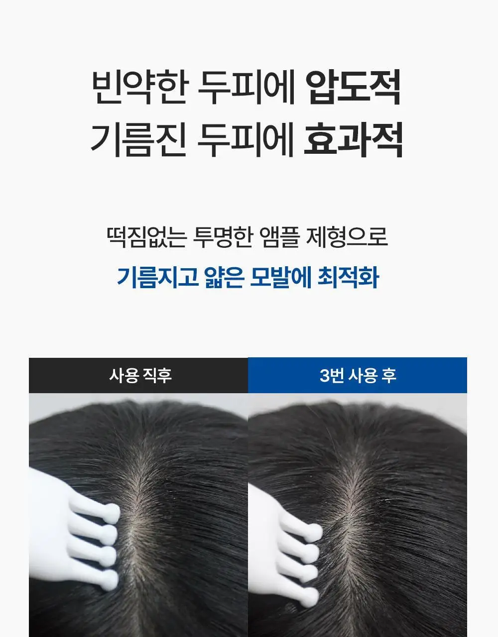 [M자복구앰플/두피괄사] 다슈 데일리 밀크씨슬 스피큘샷 스칼프 앰플 70ml 상세페이지 34